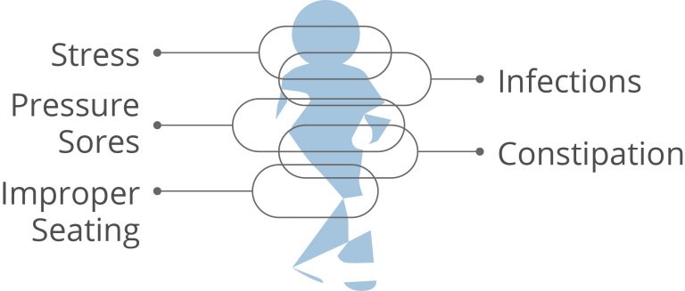 signs of spasticity
