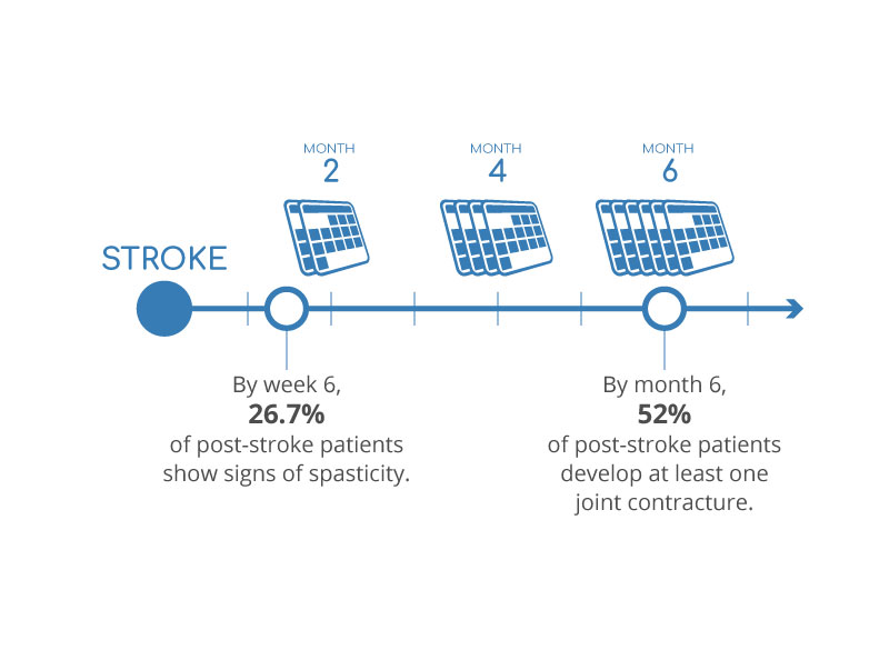 graphic illustrating a timeline of post stroke victims signs of spasticity