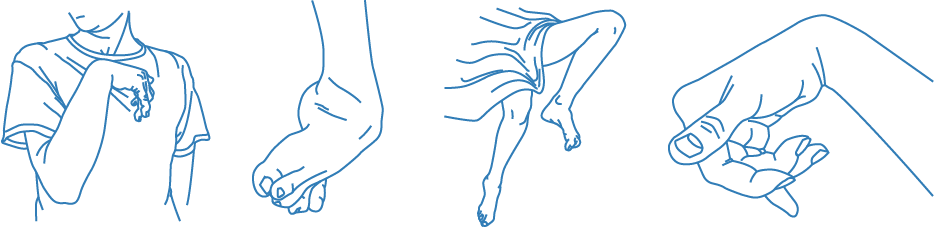 outline graphics of four body parts affected by spasticity.