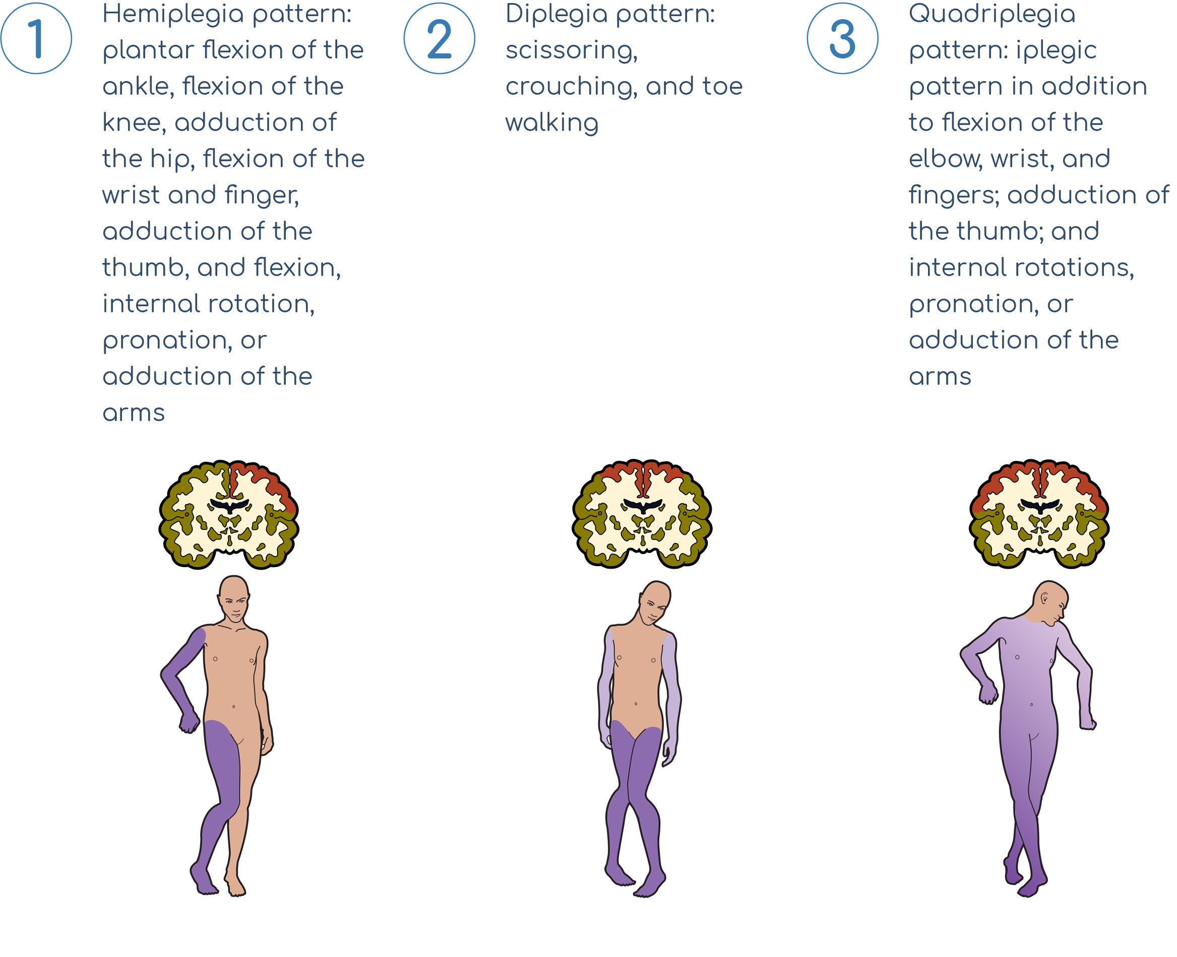 graphic displaying three types of severe spasticity