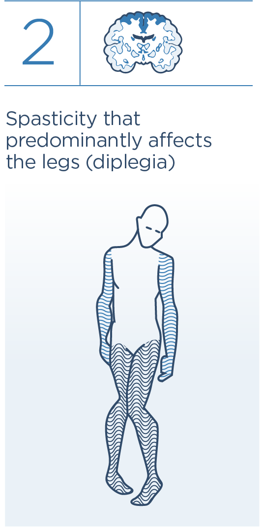 2 Spasticity that predominantly affects the legs (diplegia)